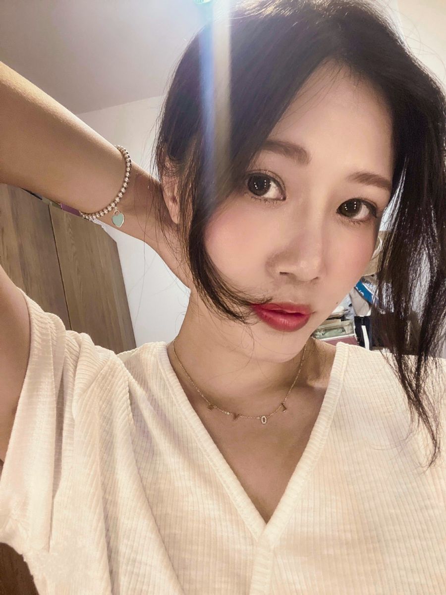 內開眼袋手術+補脂術後美照