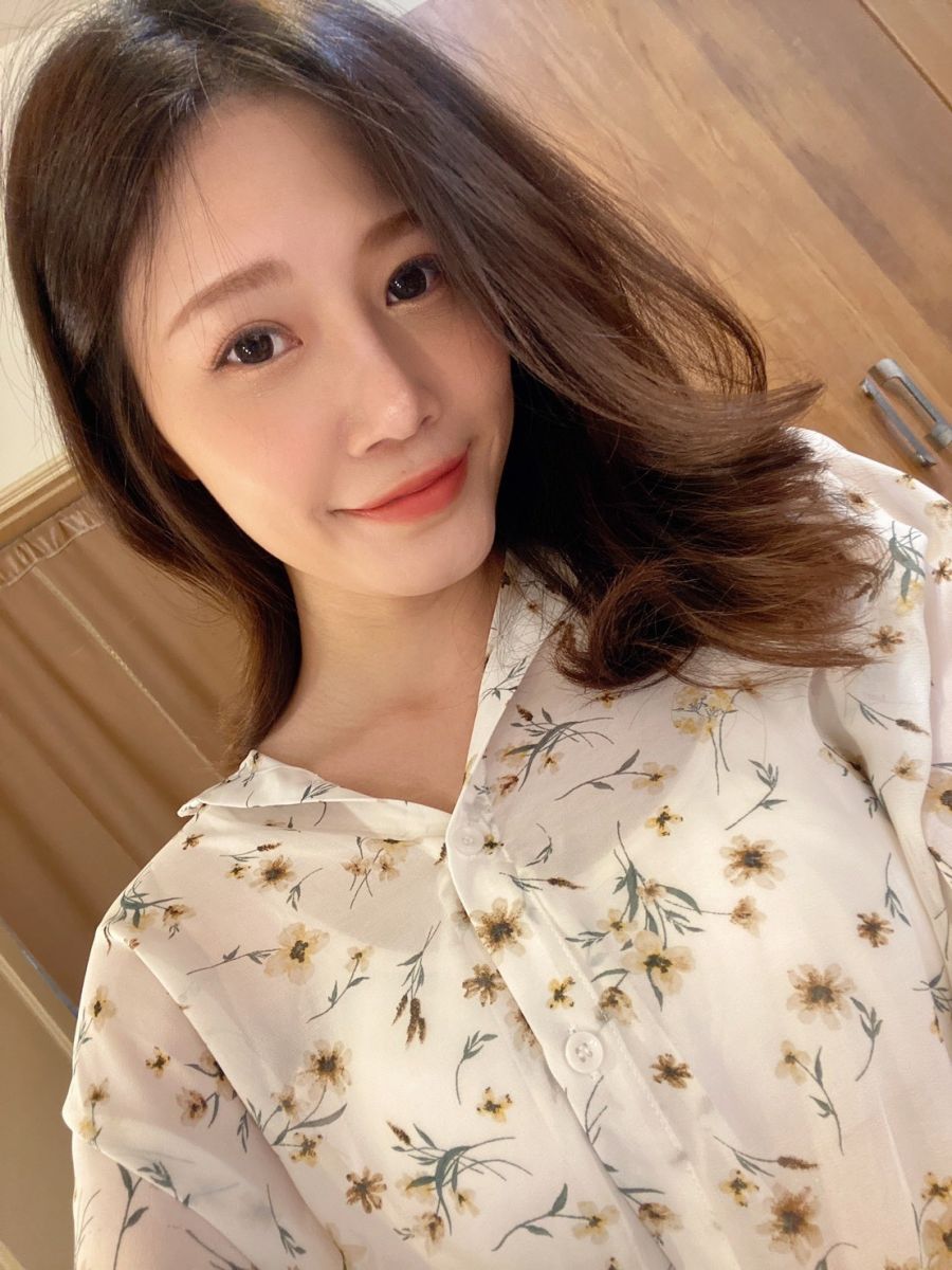 如一整形外科診所(原台北新聖)內開眼袋手術+補脂術後美照