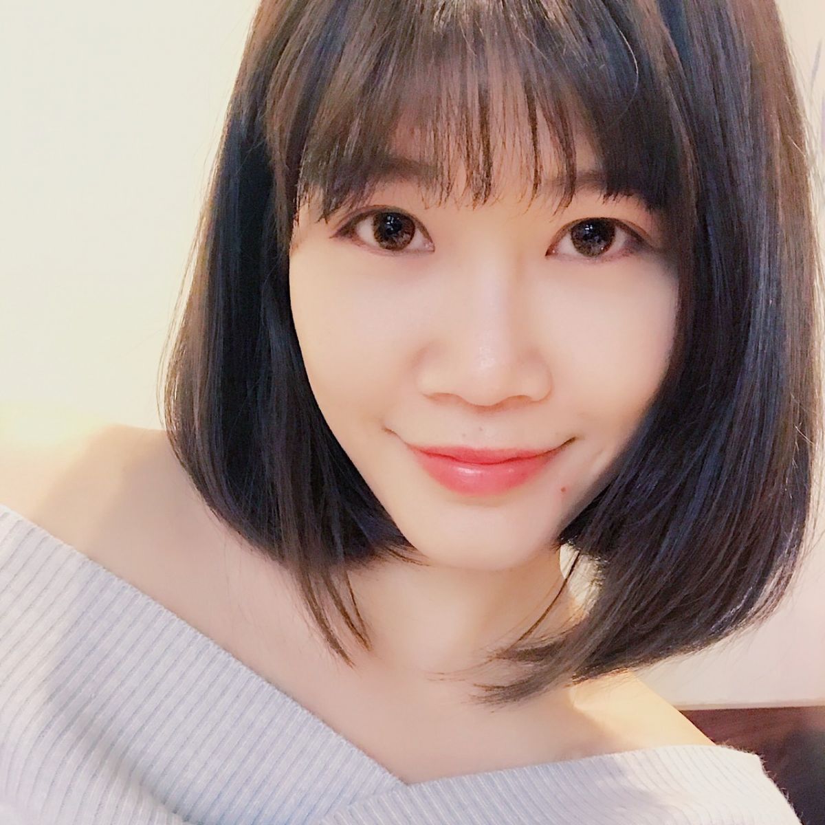 蕭奕君女醫師內開眼袋合併自體脂肪補脂術後案例