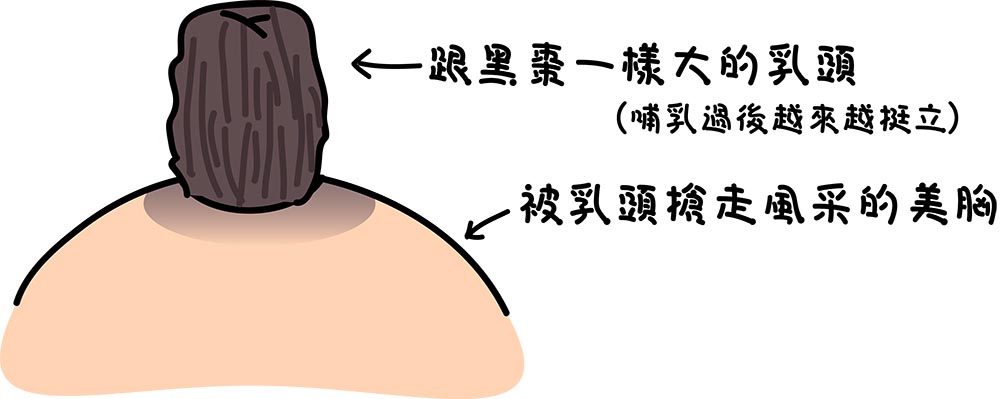 乳頭過大