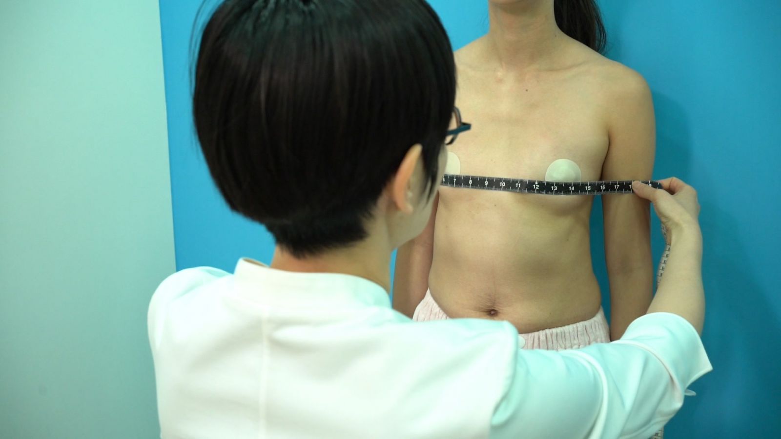蕭奕君醫師隆乳測量