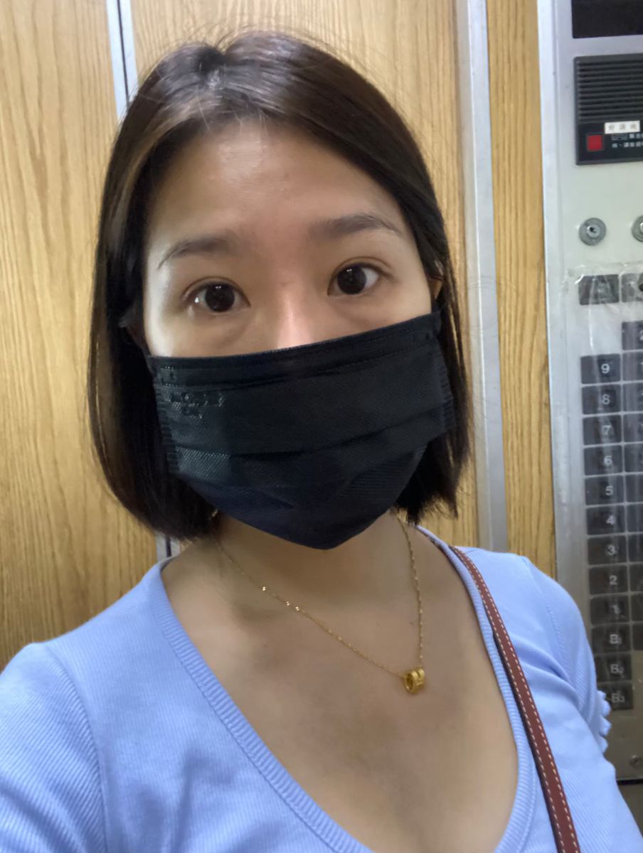 眼袋術前生活照,如一診所,蕭奕君,威萃