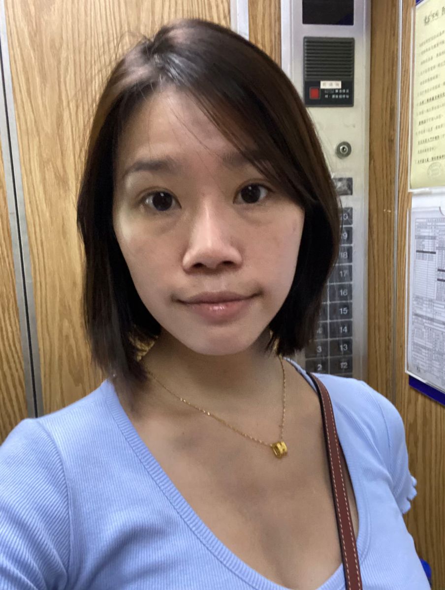 眼袋術前生活照,如一診所,蕭奕君,威萃