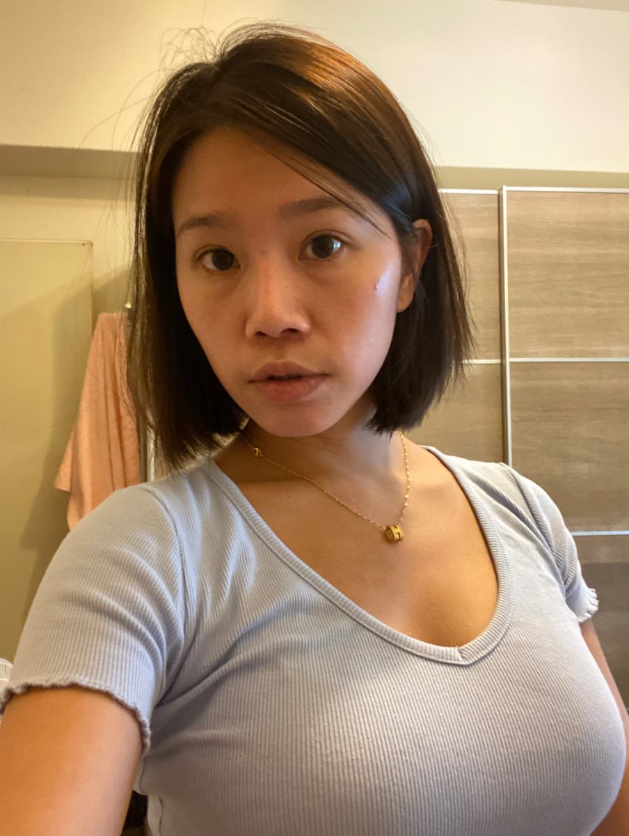 眼袋術前生活照,如一診所,蕭奕君,威萃