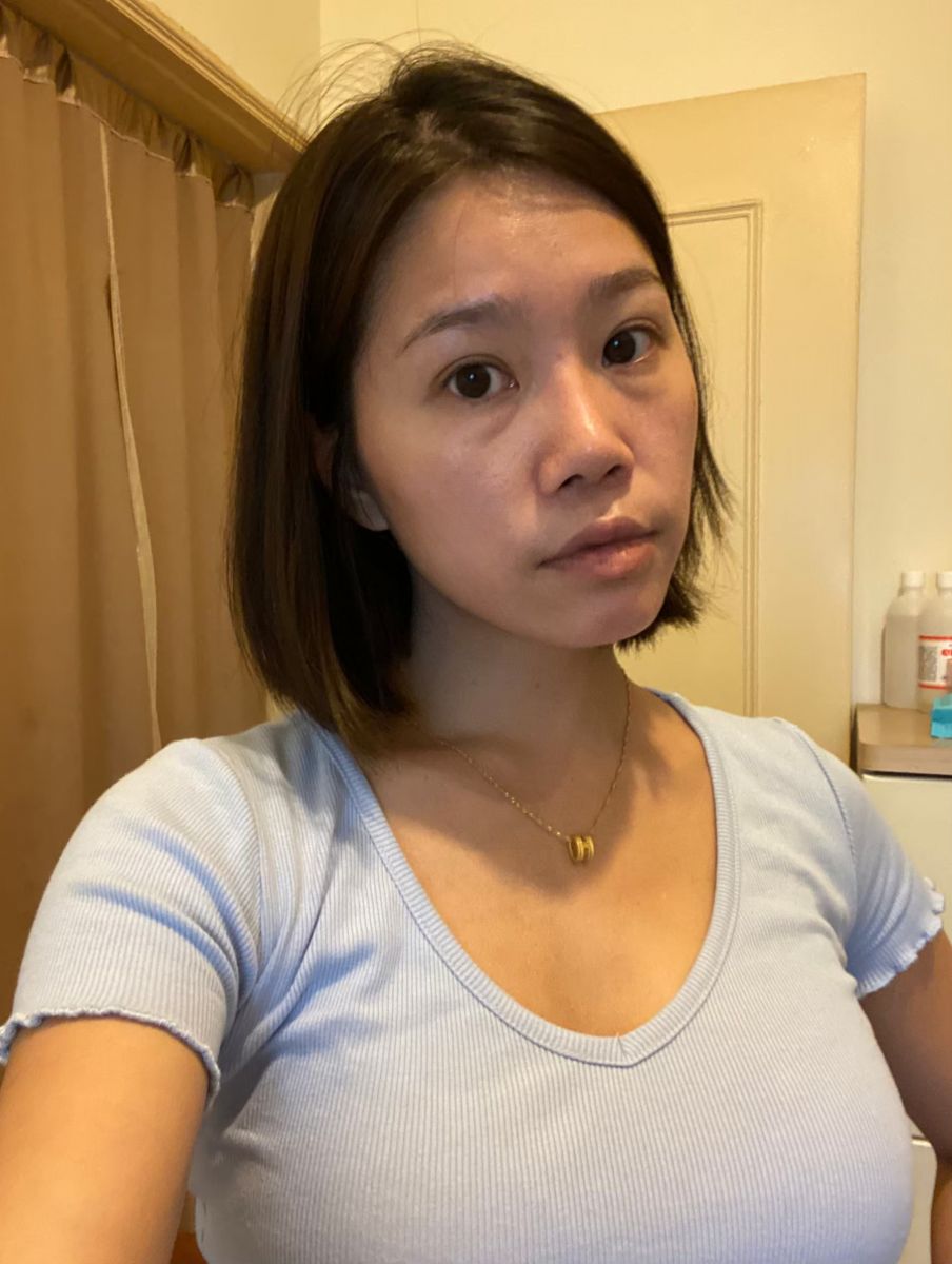 眼袋術前生活照,如一診所,蕭奕君,威萃