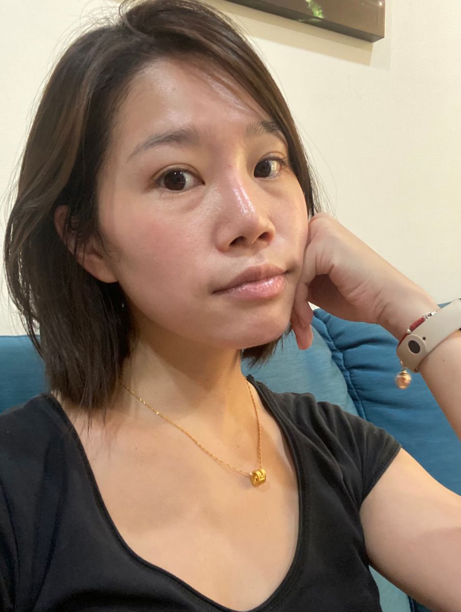 眼袋術前生活照,如一診所,蕭奕君,威萃