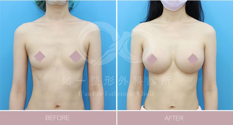 女王波案例